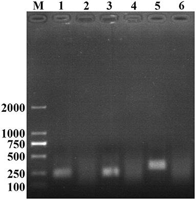 Development of Recombinase Aided Amplification Combined With Disposable Nucleic Acid Test Strip for Rapid Detection of Porcine Circovirus Type 2